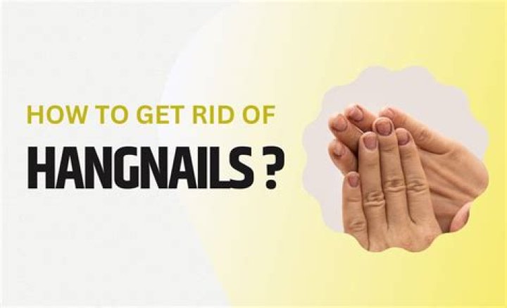 How did hangnails get their name?